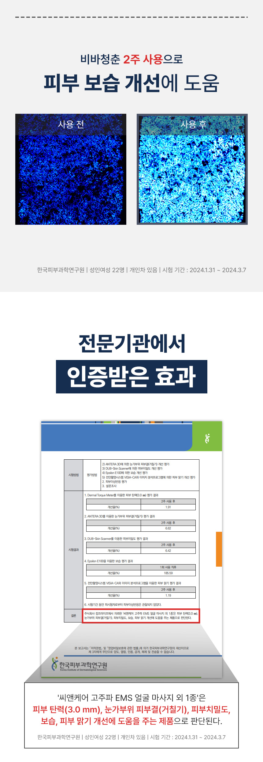 탄력탱탱 비바청춘 ESM 고주파 마사지기