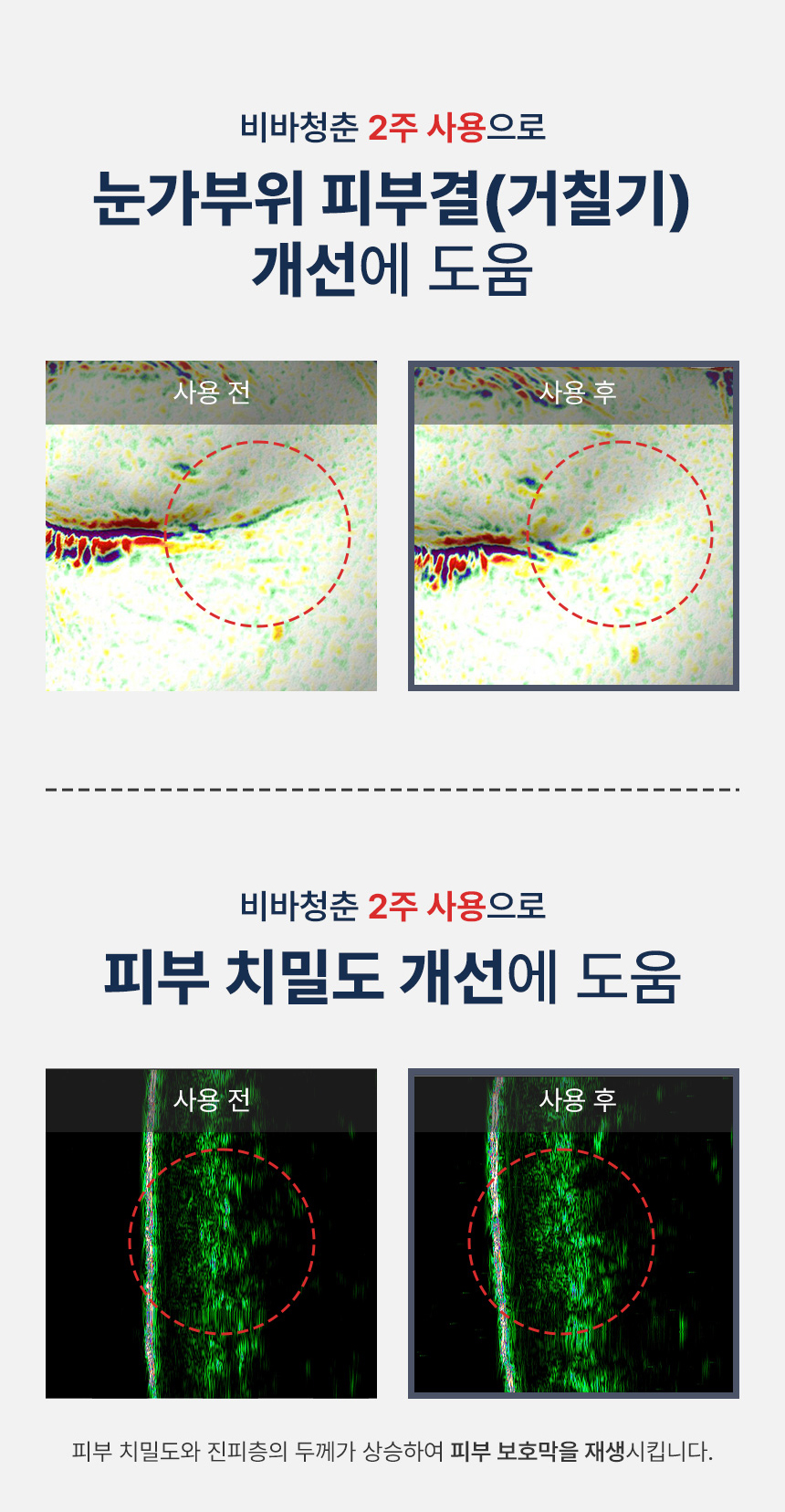 탄력탱탱 비바청춘 ESM 고주파 마사지기