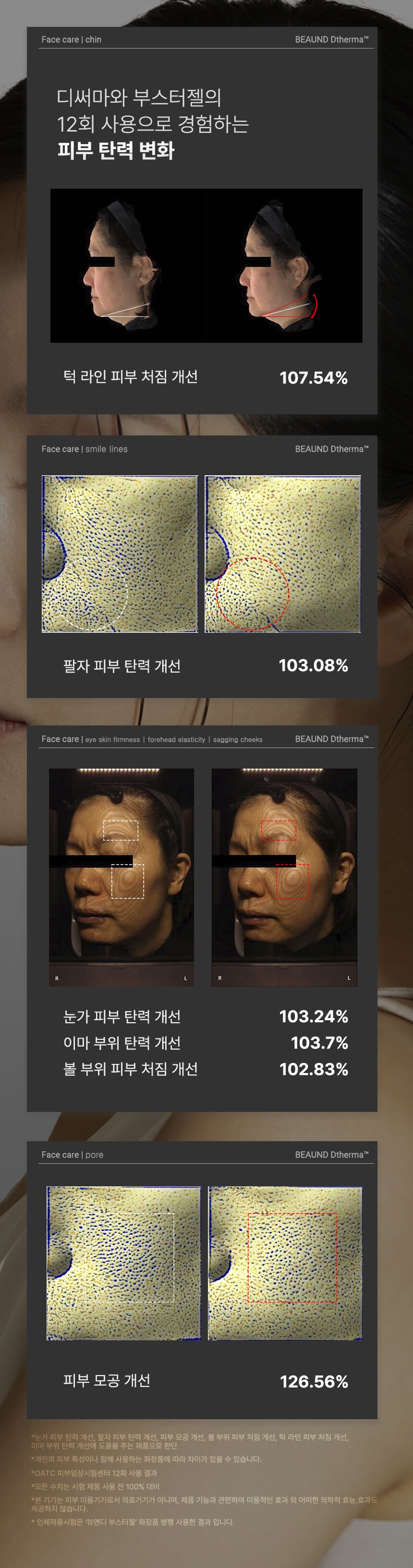 임상결과