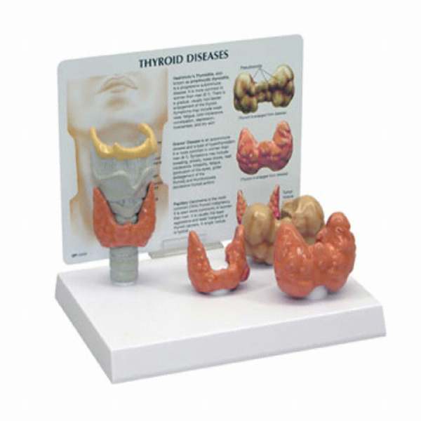 GPI G315 갑상선 질환 모형이미지입니다. 누르면 해당 게시물로 새창이동합니다.