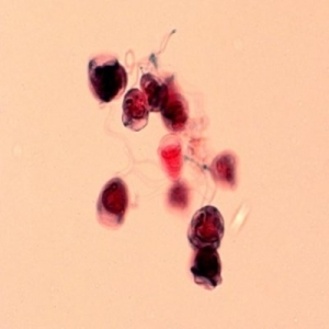 KT 섬모충류 Vorticella-종벌레  BI