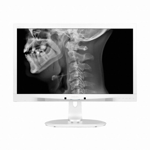 필립스 C240 Clinical review