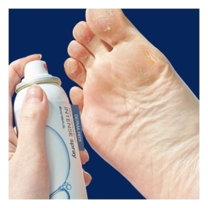 반디 더마페디 발톱발바닥 스프레이_이미지