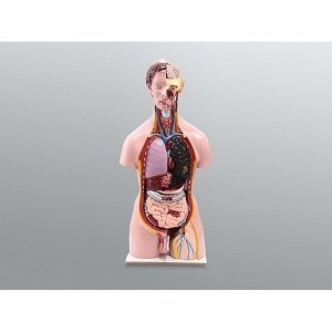 사이언스119 인체 암 질병 발생모형/JS-35823/생물