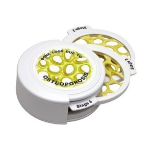 GPI G165 골다공증 4단계 모형_이미지