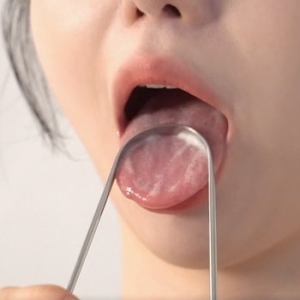 바오메디텍 덴티미 텅 스크래퍼 혀클리너이미지입니다. 누르면 해당 게시물로 새창이동합니다.