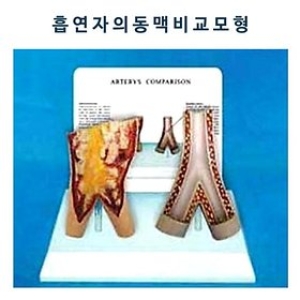 사이언스9 금연/흡연자의동맥비교모형/JS-33278