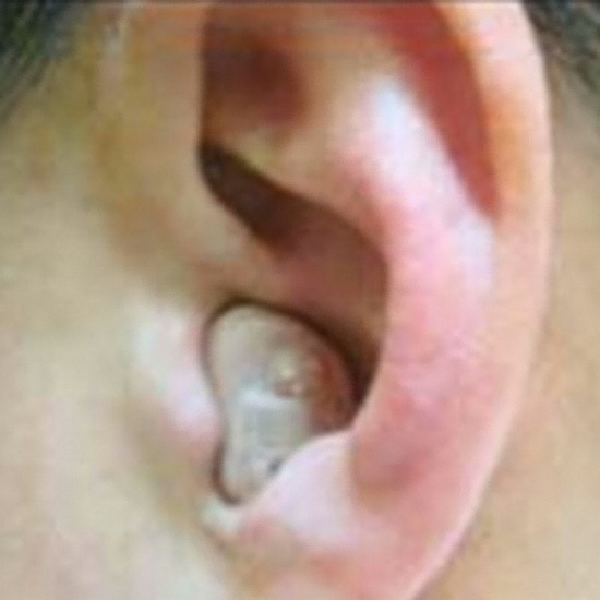 스타키 어베일100(귓속형)_이미지