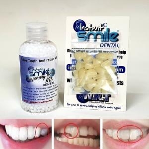 [불명] 임시치아 인공치아 수리키트 50ml이미지입니다. 누르면 해당 게시물로 새창이동합니다.